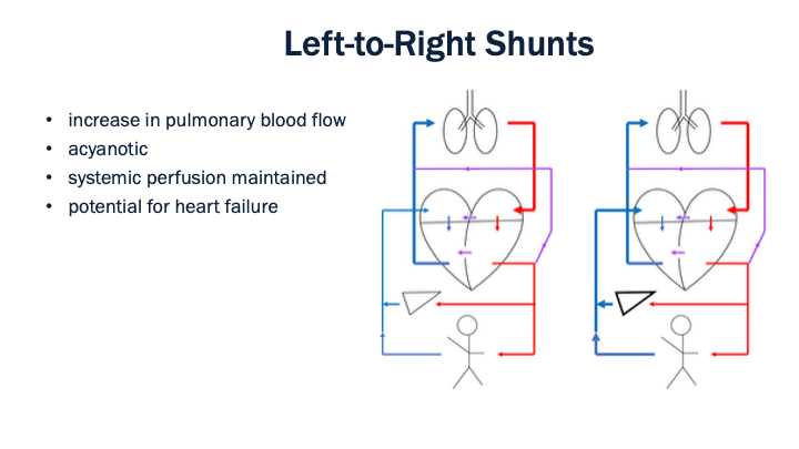 09_Left-to-Right_Shunts