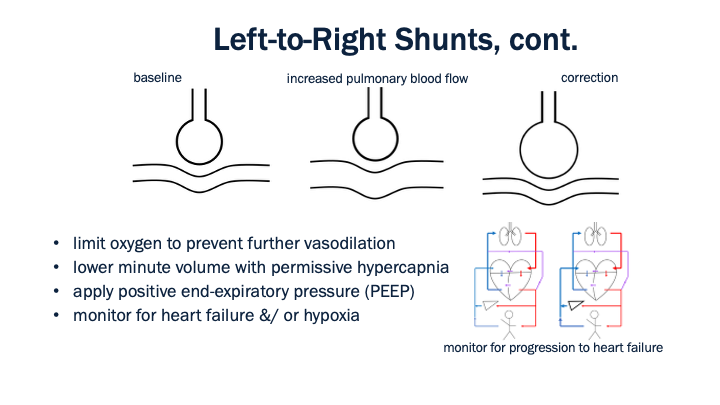 10_Left-to-Right_Shunts