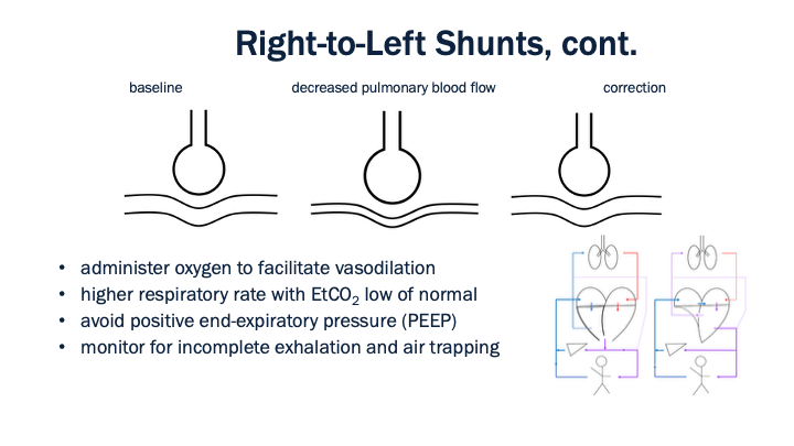 12_Right-to-Left_Shunts