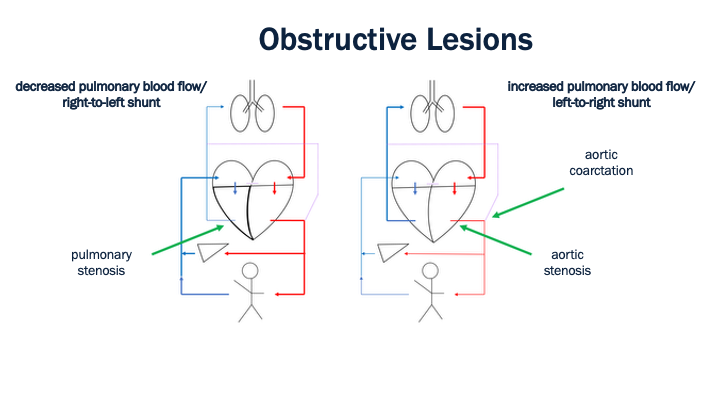 15_Obstructive_Lesions