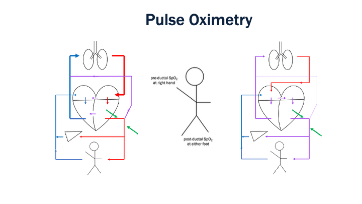 18_Pulse_Oximetry