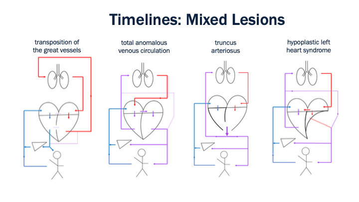 21_Timelines_Mixed_Lesions