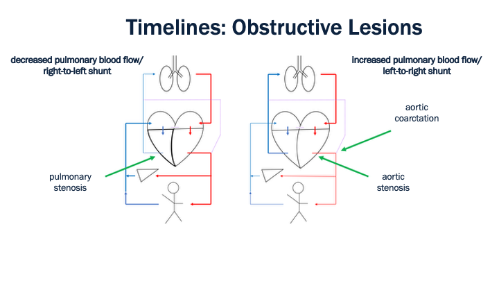 22_Timelines_Obstructive_Lesions