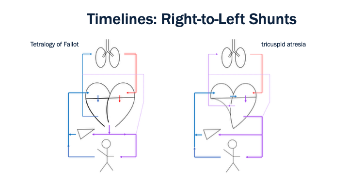 23_Timelines_Right-to-Left_Shunts