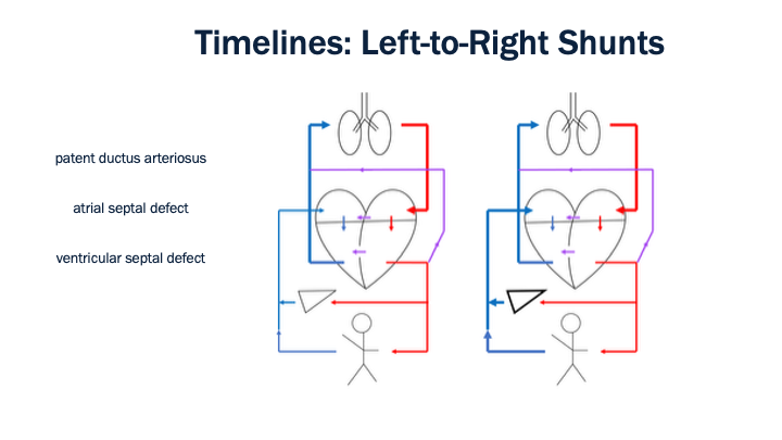 24_Timelines_Left-to_Right_Shunts