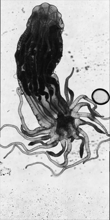 Nematostella vectensis