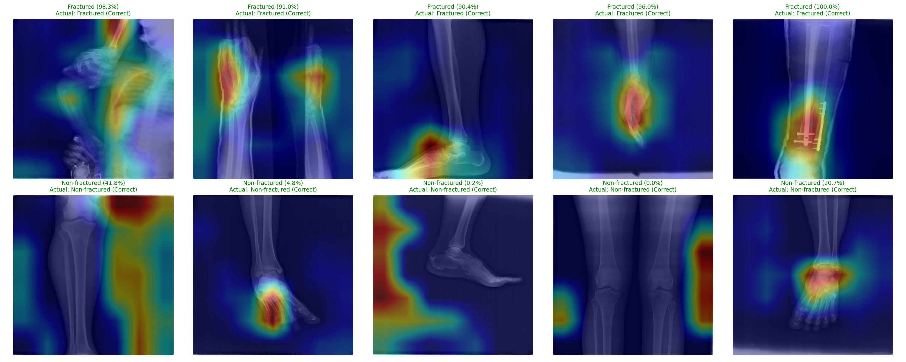 Grad-CAM heatmaps on X-rays