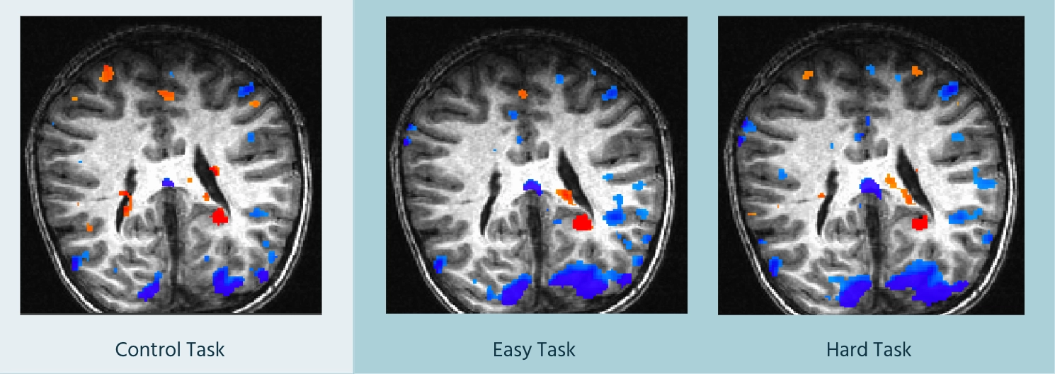 fMRI Data Analysis