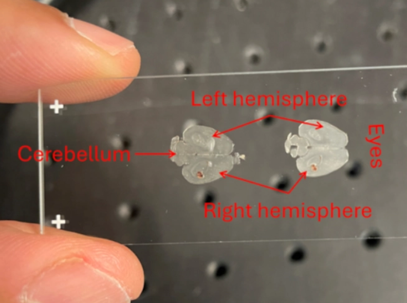 Using Lasers for Drug Delivery