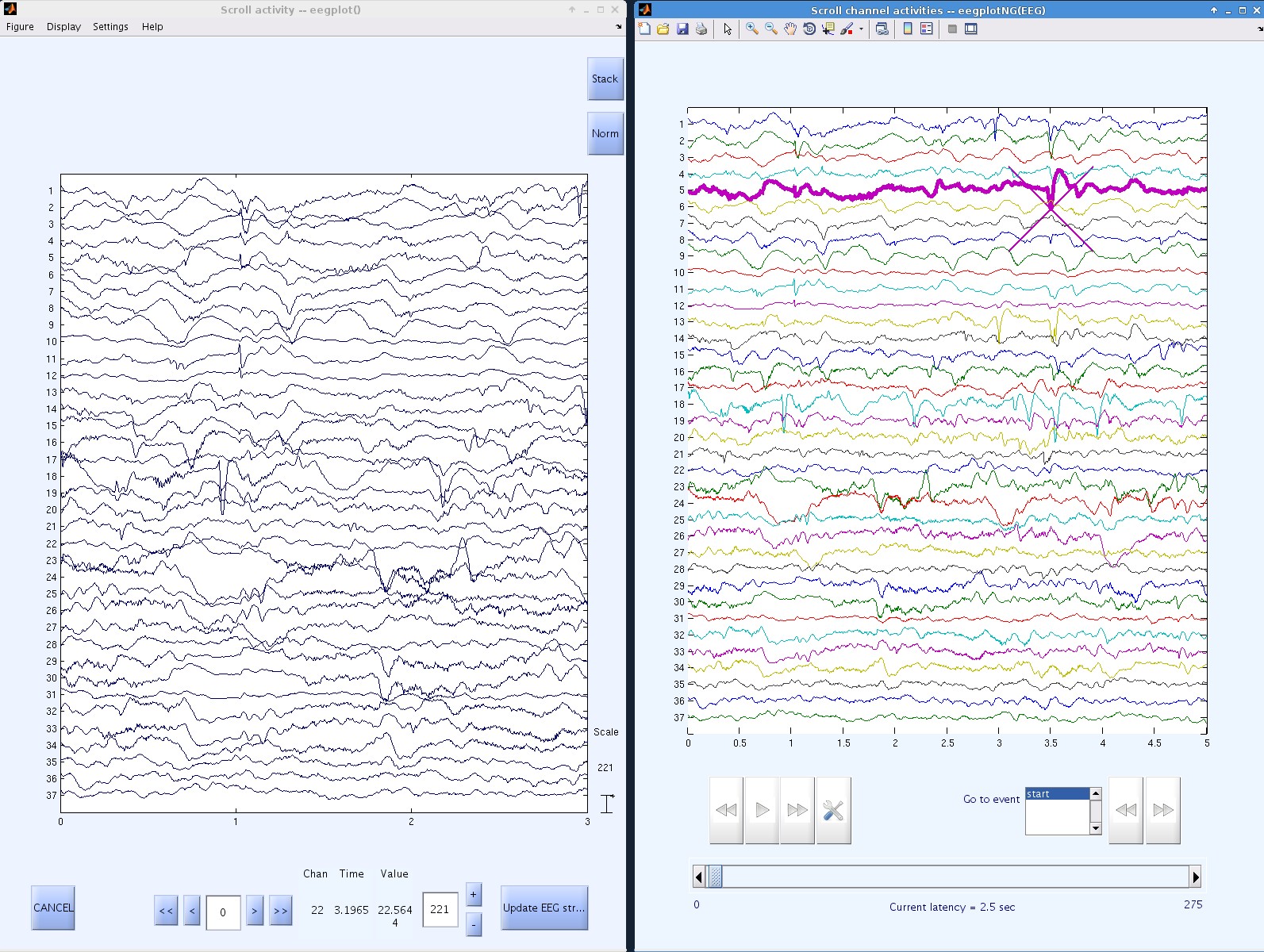 Figure 4. Manually marking HFOs. Left, using VisEd.
Right, using customized MoBILAB plots.