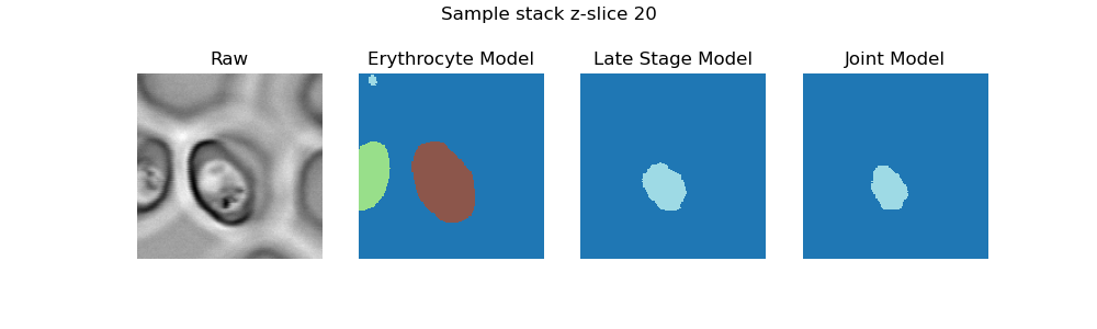 z-slice of segmentations