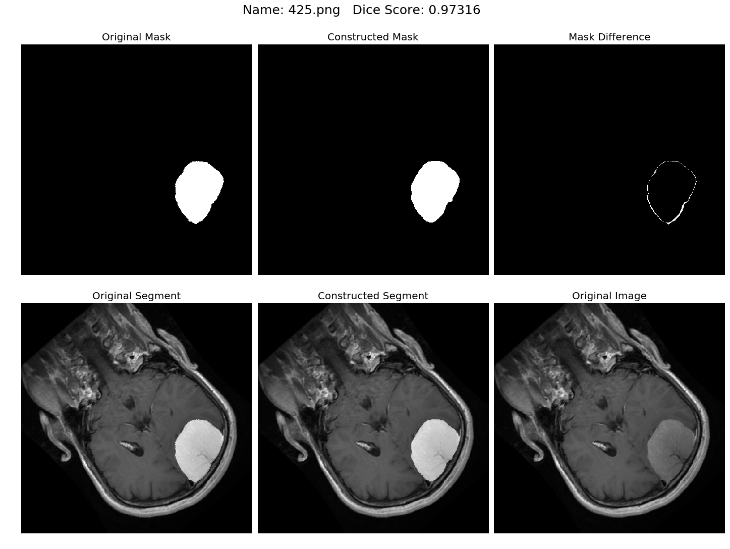 Brain Tumor Segmentation