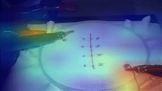 Suturing worse performance