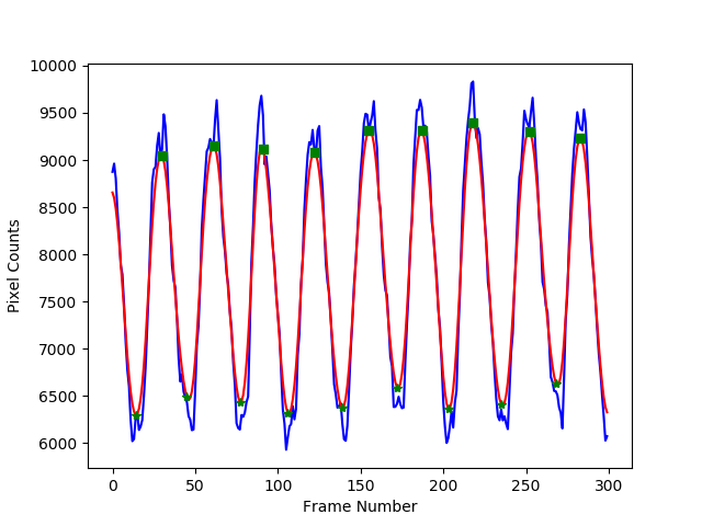 CardiacPhases