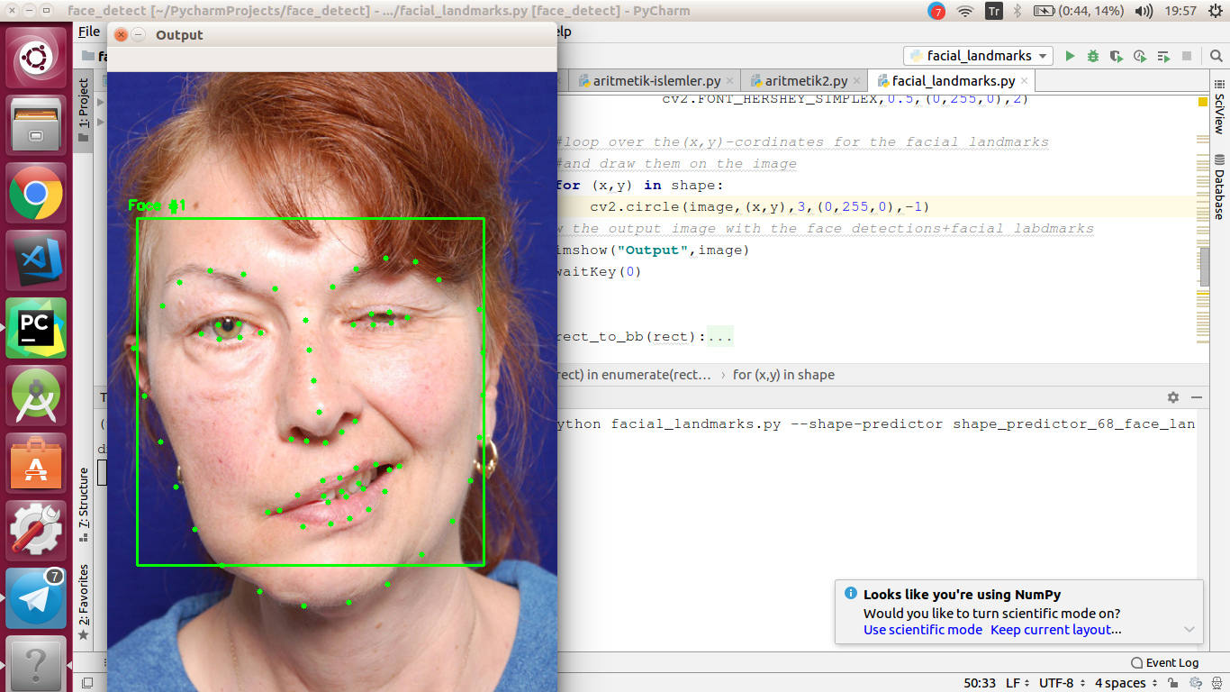 Facial Paralysis Detection Sample