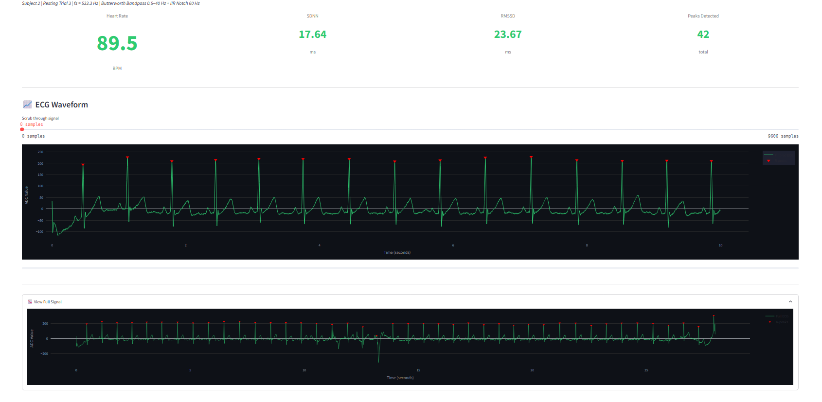 ECG-Biosensor-AD8232, from the project README