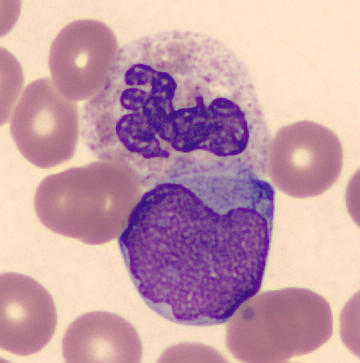 Patient_07/Signed slides/Segmented neutrophils/SNE_9285096.jpg