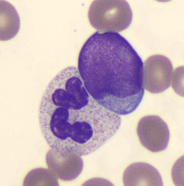 Patient_30/Signed slides/Segmented neutrophils/SNE_8371873.jpg