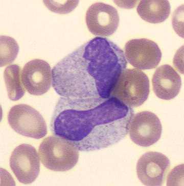 Patient_83/Signed slides/Segmented neutrophils/MMY_30638460.jpg