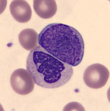 Patient_86/Signed slides/Segmented neutrophils/SNE_18130692.jpg