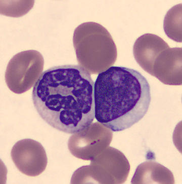 Patient_86/Signed slides/Segmented neutrophils/SNE_18130706.jpg