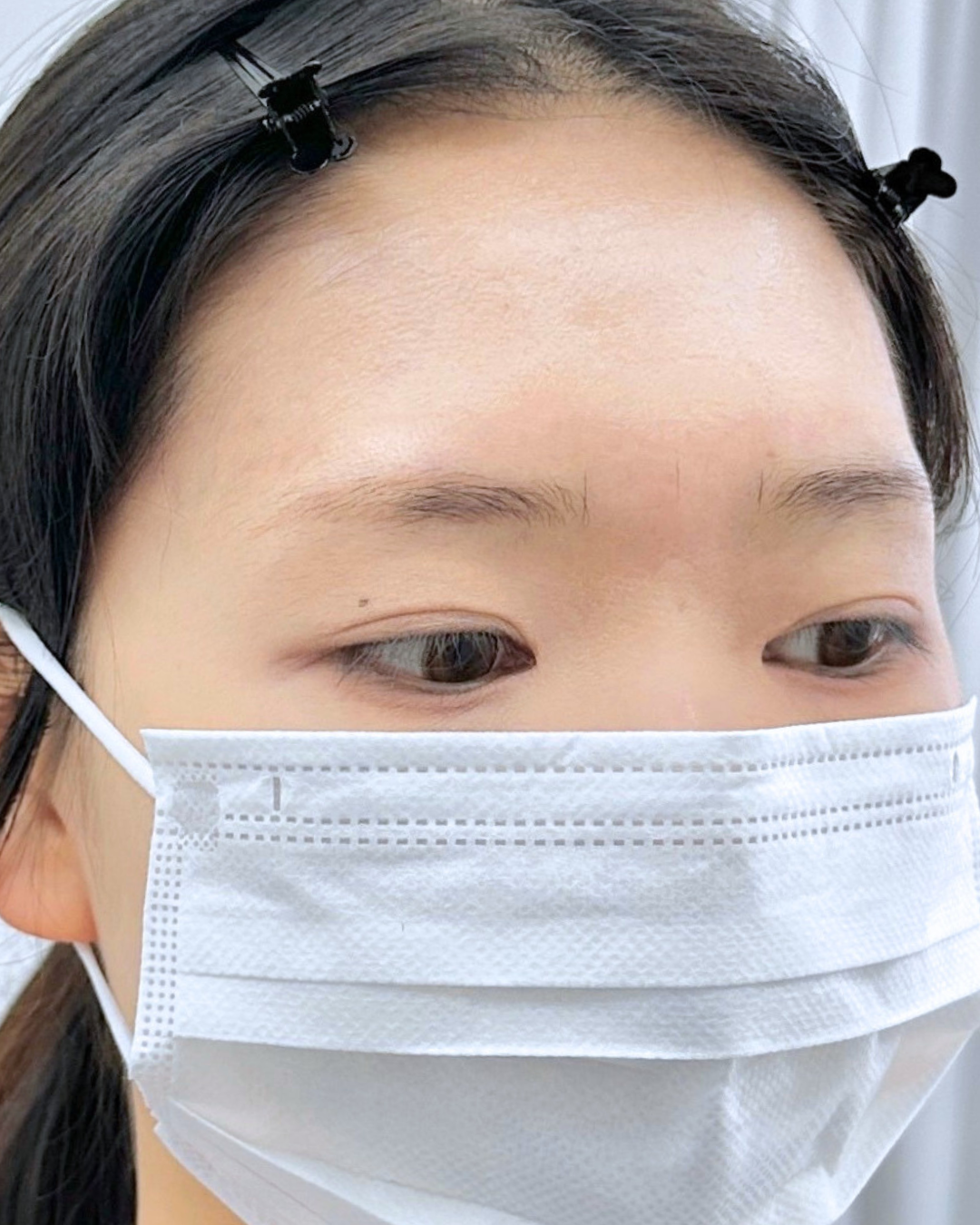강릉 눈썹문신 자연눈썹 시술 전