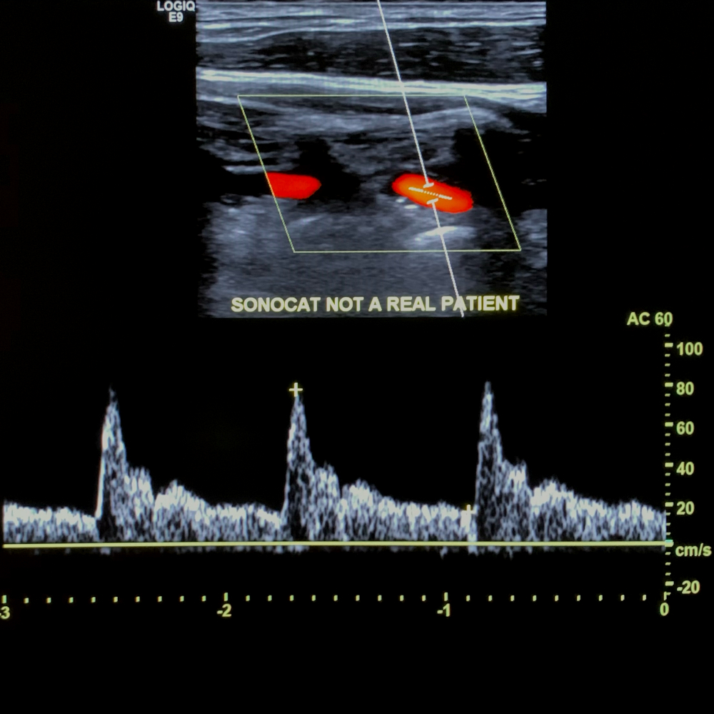 SonoCat - Practical Guide to General Sonography