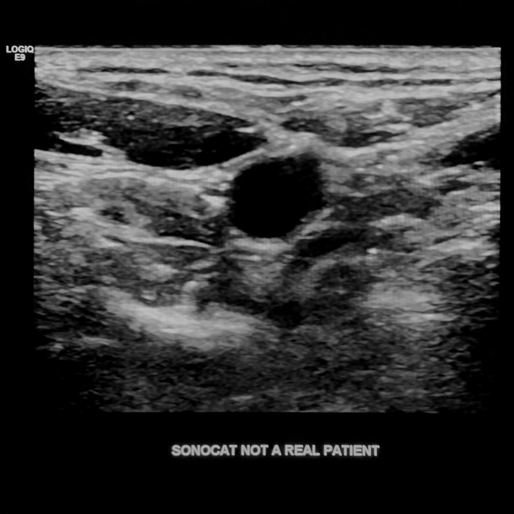 SonoCat - Practical Guide to General Sonography