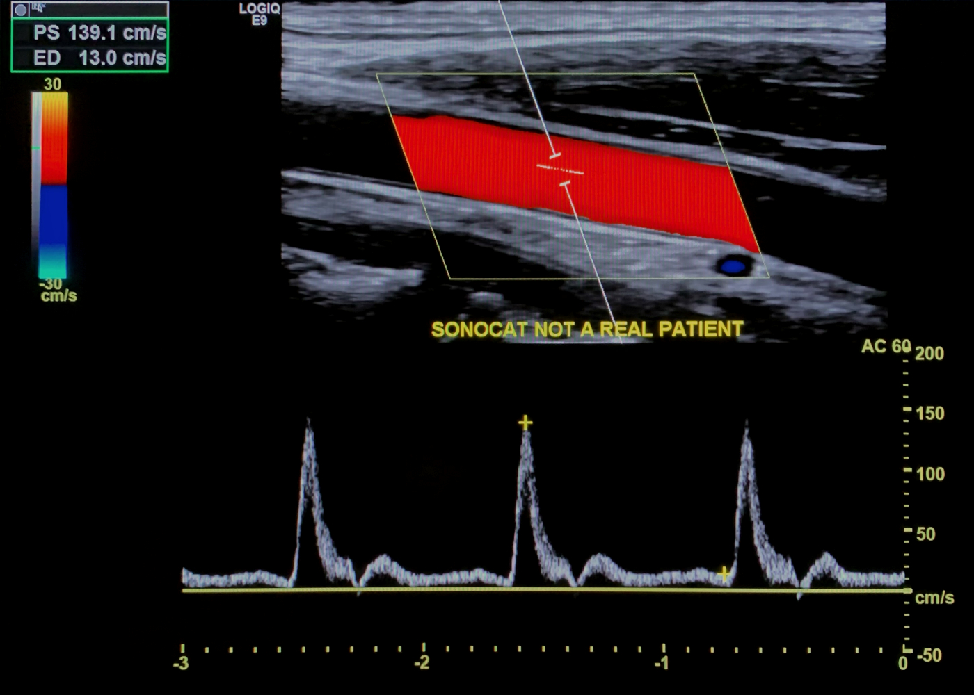 SonoCat - Practical Guide to General Sonography