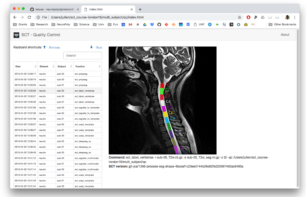 https://raw.githubusercontent.com/spinalcordtoolbox/doc-figures/master/batch-processing-of-subjects/qc.png