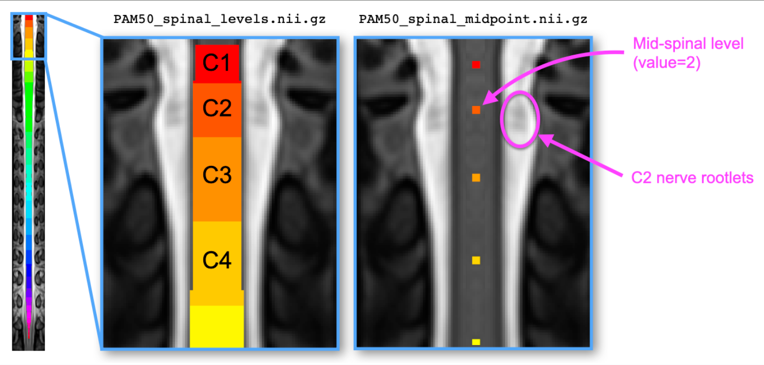 https://raw.githubusercontent.com/spinalcordtoolbox/doc-figures/master/processing-fmri-data/spinal-levels.png