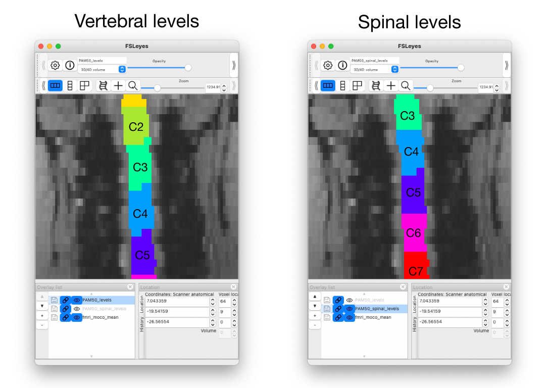 https://raw.githubusercontent.com/spinalcordtoolbox/doc-figures/master/processing-fmri-data/spinal_levels_illustration.png