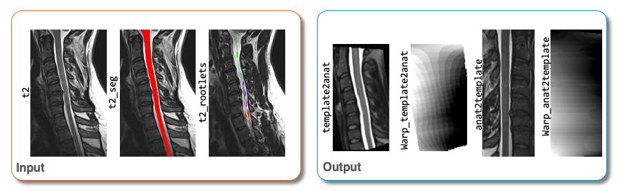 https://raw.githubusercontent.com/spinalcordtoolbox/doc-figures/master/rootlets-based-registration/output-registration-rootlets.png