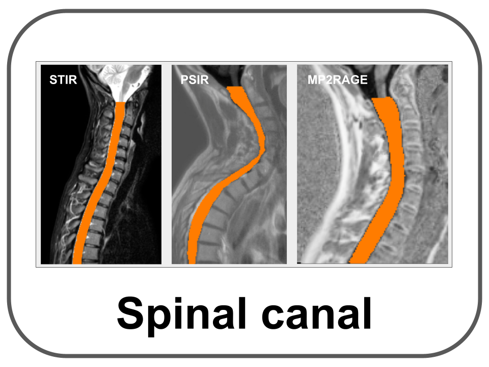 canal