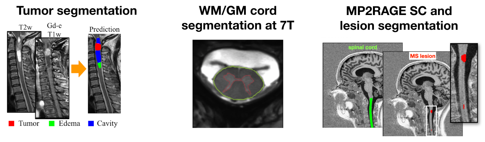 https://raw.githubusercontent.com/spinalcordtoolbox/doc-figures/master/spinalcord-segmentation/sct_deepseg_models.png