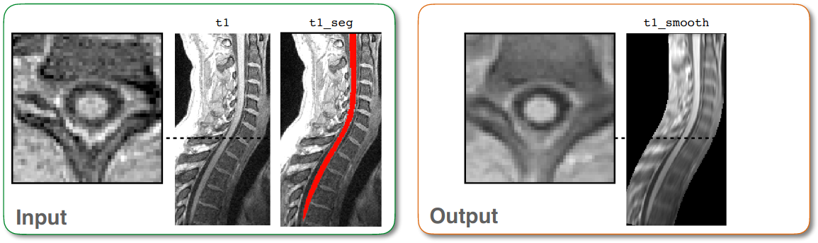 https://raw.githubusercontent.com/spinalcordtoolbox/doc-figures/master/spinalcord-smoothing/io-sct_smooth_spinalcord.png