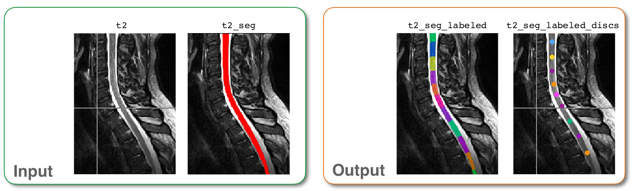 https://raw.githubusercontent.com/spinalcordtoolbox/doc-figures/master/vertebral-labeling/io-sct_label_vertebrae.png