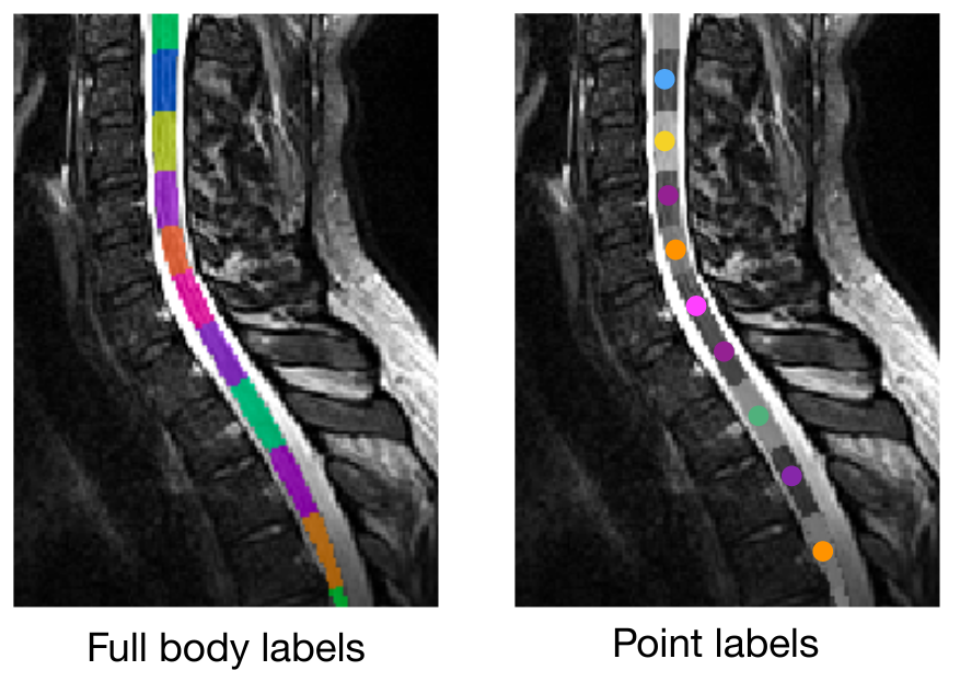 https://raw.githubusercontent.com/spinalcordtoolbox/doc-figures/master/vertebral-labeling/vertebral-labeling-label-types.png