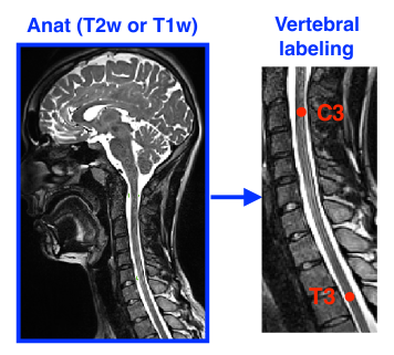 https://raw.githubusercontent.com/spinalcordtoolbox/doc-figures/master/vertebral-labeling/vertebral-labeling.png