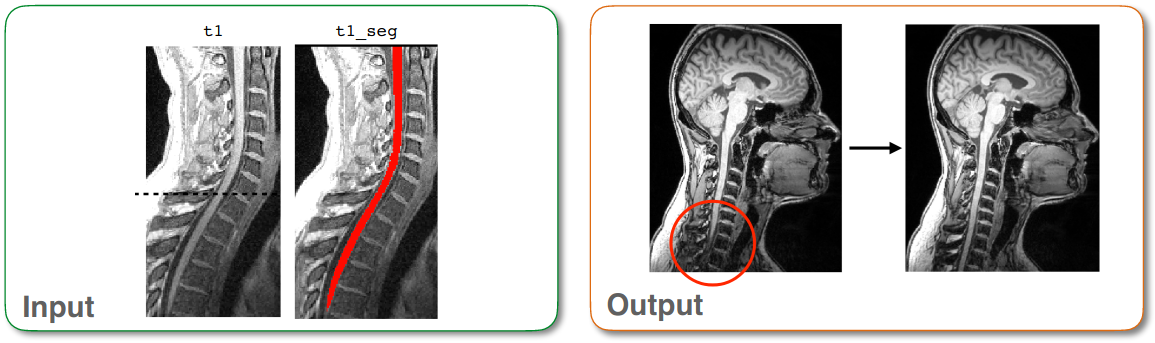 https://raw.githubusercontent.com/spinalcordtoolbox/doc-figures/master/visualizing-misaligned-cords/io-sct_flatten_sagittal.png