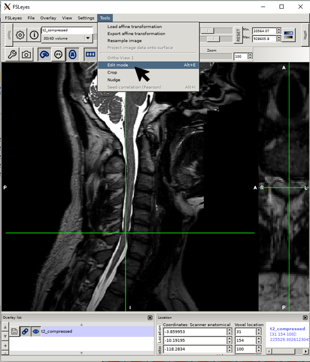 https://raw.githubusercontent.com/spinalcordtoolbox/doc-figures/sb/4158-add-tutorial-sct-compute-compression/spinalcord-compresssion-norm/edit_mode.png