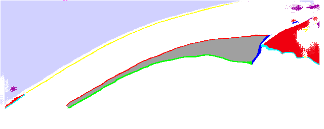 Segmented ciliary muscle