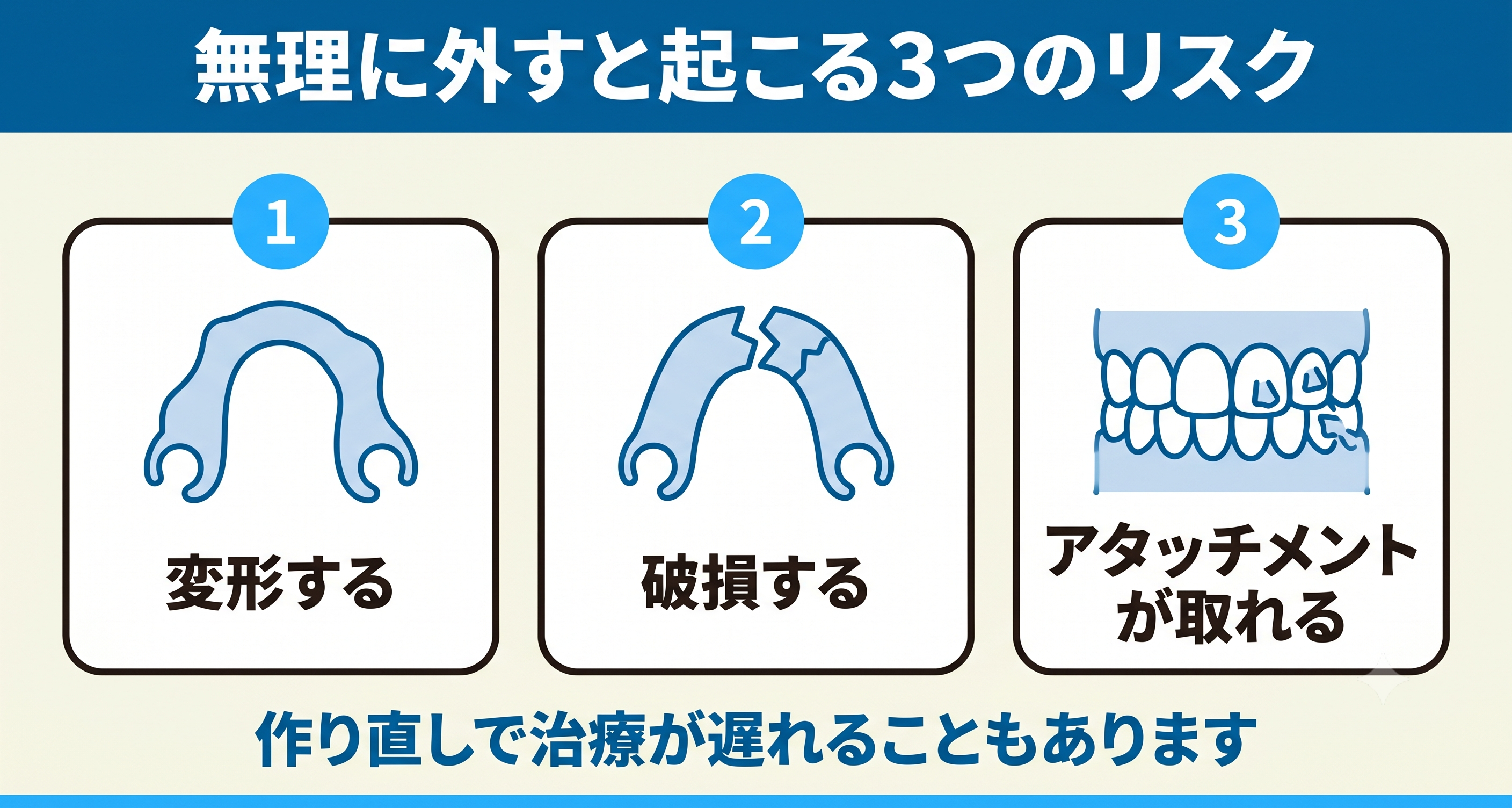 インビザラインを無理に外すと起こる3つのリスクを整理した図解。マウスピースの変形・破損・アタッチメントの脱離を並べ、自己流の外し方が作り直しによる治療の遅れにつながりうることを示す。