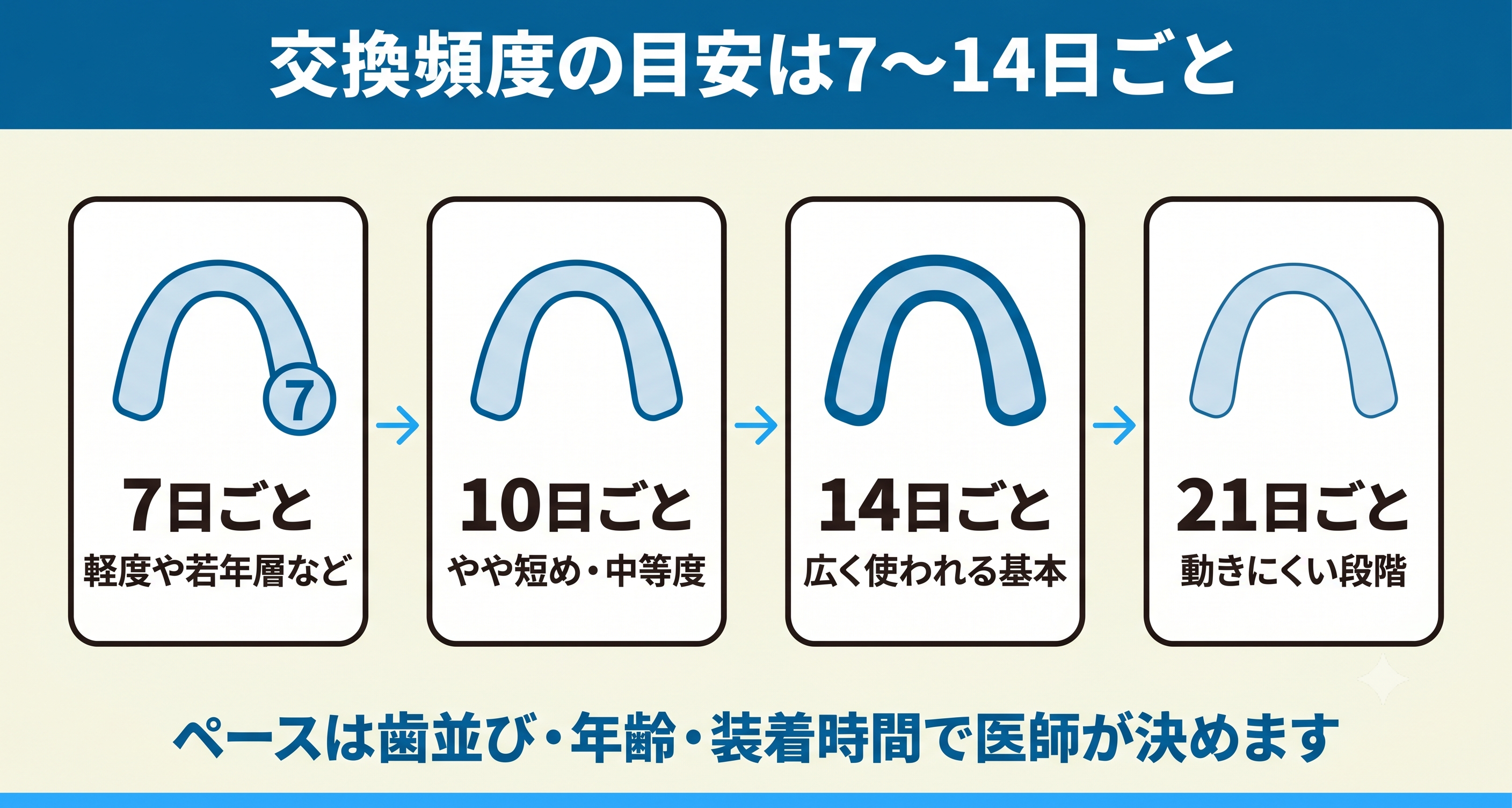 インビザラインのマウスピース交換頻度の基本サイクルを整理した図解。7日ごと・10日ごと・14日ごと・21日ごとの代表的な交換ペースと採用されやすい状況を並べ、ペースは歯並び・年齢・装着時間をもとに医師が決めることを示す。