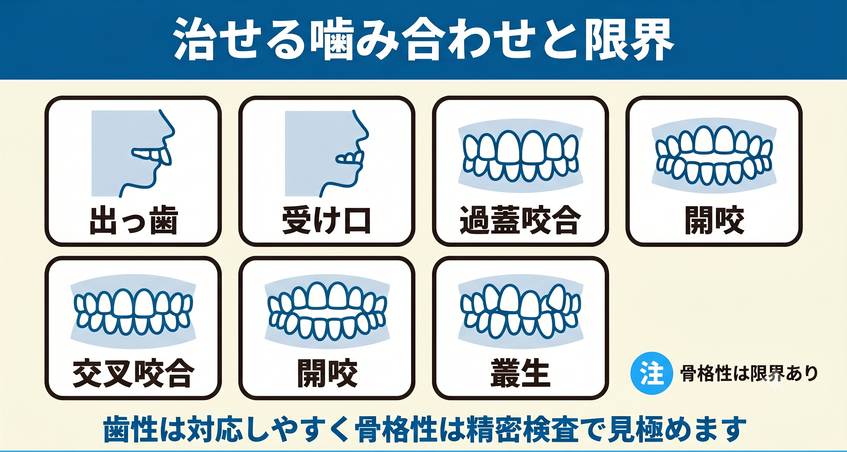 インビザラインで治せる噛み合わせの種類と限界を整理した図解。出っ歯・受け口・過蓋咬合・開咬・交叉咬合・叢生の6タイプをカードで並べ、歯性のケースは対応しやすく、骨格性のケースは限界があり精密検査で見極めることを示す。