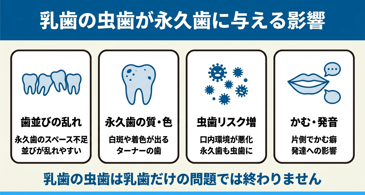 乳歯の虫歯を放置した場合に永久歯へ及ぶ可能性のある影響を整理した図解。永久歯のスペース不足による歯並びの乱れ、白斑や着色などの質・色への影響、虫歯リスク増、かむ・発音への影響を4枚のカードで示す歯科情報イラスト。
