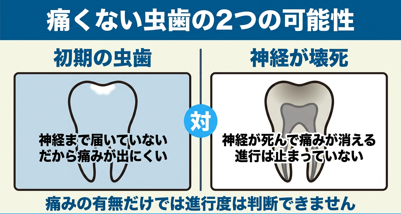 痛くない虫歯には初期の虫歯と神経の壊死という正反対の2つの可能性があることを左右で対比した図解。左は神経まで届かず痛みが出にくい初期、右は神経が死んで痛みが消えても進行は止まっていない状態を示し、痛みの有無だけでは進行度を判断できないことを伝える。