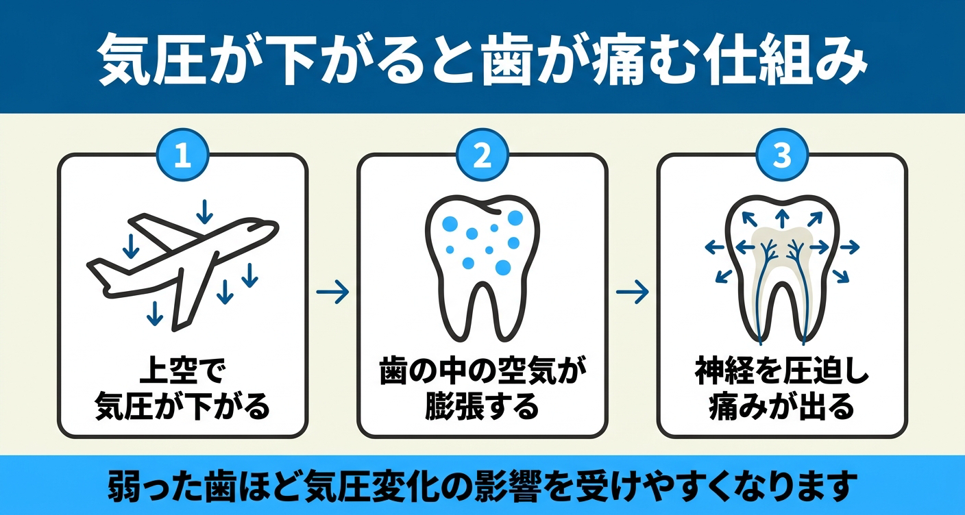 飛行機で虫歯が痛む仕組みを3ステップで示した図解。上空で気圧が下がり、歯の中の空気が膨張し、神経を刺激して痛みが出る場合がある流れを順に並べ、弱った歯ほど気圧変化の影響を受けやすいことを伝える航空性歯痛の解説イラスト。