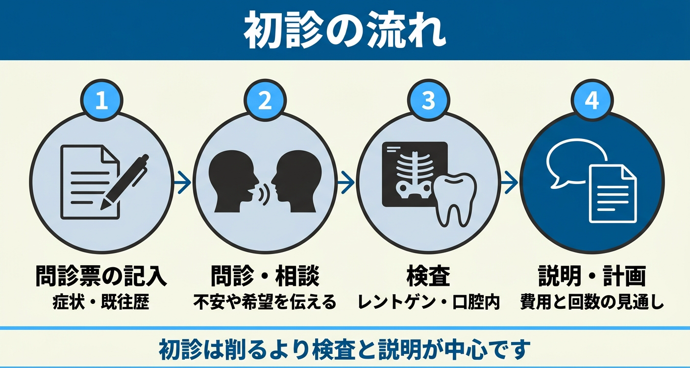 虫歯治療の初診の流れを4ステップで示した図解。問診票の記入、問診・相談、レントゲンなどの検査、診断結果と費用・回数の説明という順に並べ、初診は虫歯を削るより検査と説明が中心であることを伝える歯科情報イラスト。