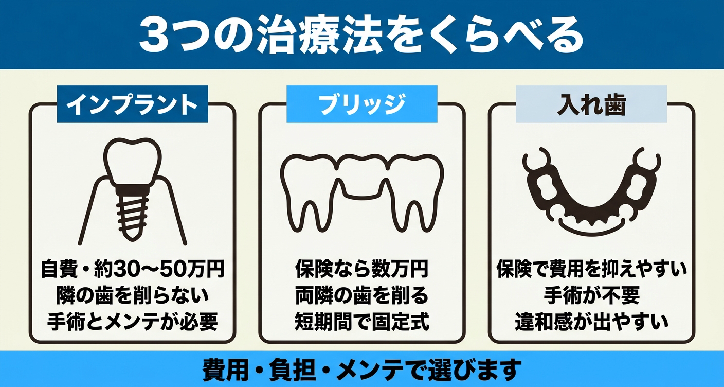 インプラントとブリッジ・入れ歯の治療法を比較した図解
